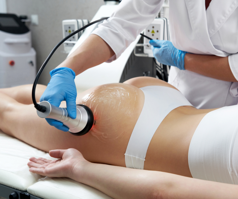 Non-surgical Body Contouring in Chicago