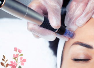 How Long Does Redness Last After Microneedling? How Long Does Redness Last After Microneedling