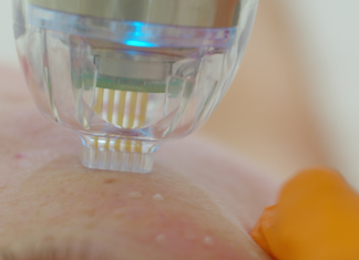 Can I Use Sunscreen After Microneedling? Skin Aftercare Can I Use Sunscreen After Microneedling Skin Aftercare