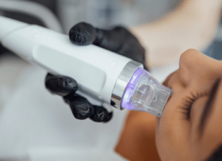 ¿Ayuda el Microneedling a la Melasma? Detalles que Necesitas Saber Does Microneedling Help Melasma chicago treatment