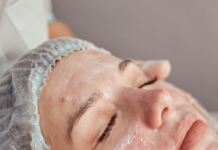 Por Qué Tu Piel Aún Presenta Brotes Después de una Limpieza Facial y Cómo Prevenirlo Best Acne Facial Treatment in Chicago for Acne-Prone Skin 2
