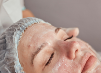 Achieving Flawless Skin: The Benefits of Customized Facials in Chicago Best Acne Facial Treatment in Chicago for Acne-Prone Skin 2