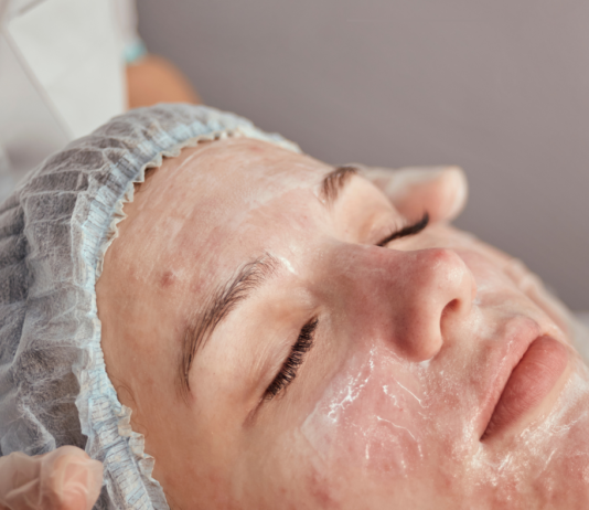 Por Qué Tu Piel Aún Presenta Brotes Después de una Limpieza Facial y Cómo Prevenirlo Best Acne Facial Treatment in Chicago for Acne-Prone Skin 2