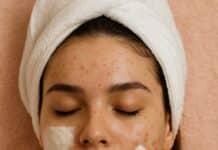 Por Qué Tu Acné No Desaparece: 7 Errores Que Casi Todas Las Mujeres Cometen y Que Una Esteticista Detecta al Instante Why Your Acne Is Not Going Away mistakes