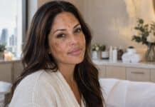 Mejor Facial para Melasma e Hiperpigmentación en Chicago: Qué Buscar Antes de Reservar Best facial for melasma Chicago