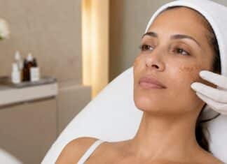 Tratamiento para el Melasma en Chicago: Qué Ayuda Realmente con las Manchas Oscuras y Qué Puede Empeorarlas best facial for melasma anti aging chicago