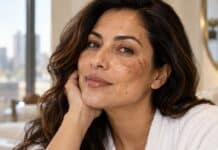 Melasma vs. Manchas Solares vs. Hiperpigmentación por Acné: Cómo Saber la Diferencia Melasma vs. Sun Spots vs. Post Acne Hyperpigmentation